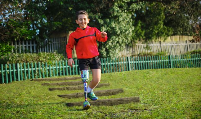 Pediatric Prosthetics