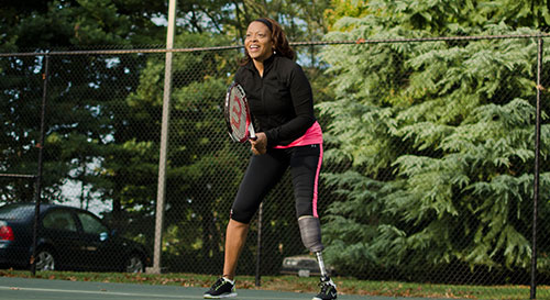 Below Knee Prosthetics