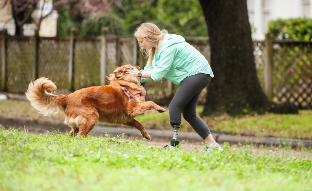 Below Knee Prosthetics
