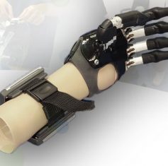 Össur – iLimb Digits Quantum