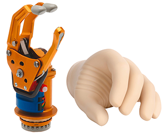 Myoelectric Speed Hands – SensorHand Speed and VariPlus Hand