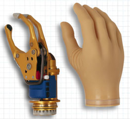 Myoelectric Speed Hands - SensorHand Speed And VariPlus Hand | MCOP ...