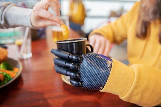 Össur – i-Digits™ Quantum