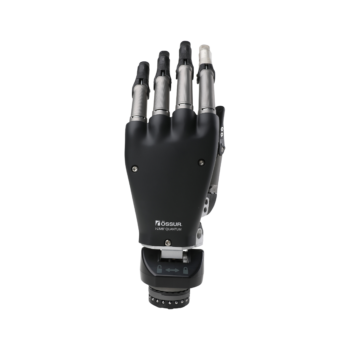 Össur - i-Digits™ Quantum Partial Hand Prosthesis | MCOP Prosthetics