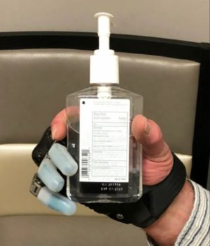 Partial Hand Solutions – Titan Fingers