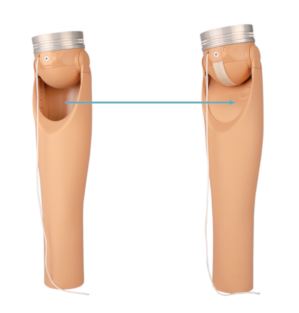 Ottobock – ErgoArm & ErgoArm Electronic Plus
